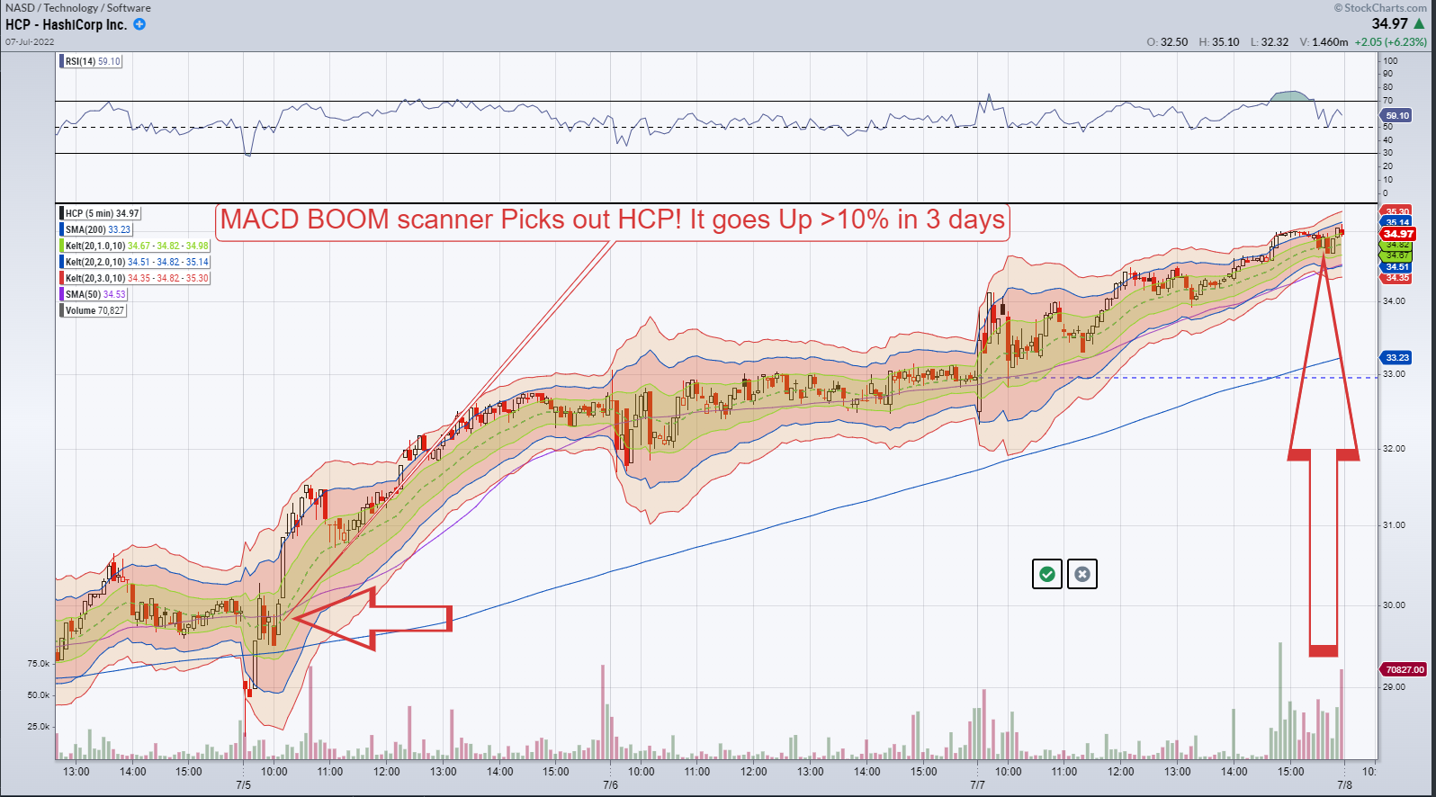 BOOM SCANNER PICKS HCP